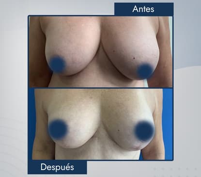 Slider image (6) Dr. Jose E. Telich - Plastic Surgeon